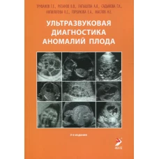 Ультразвуковая диагностика аномалий плода: Руководство для врачей. 3-е изд. Труфанов Г.Е., Рязанов В.В., Латышева А.Я.