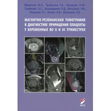 Магнитно-резонансная томография в диагностике приращения плаценты у беременных во II и III триместрах: Учебное пособие. Труфанов Г.Е., Мащенко И. А., Ефимцев А. Ю.