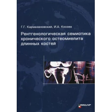 Рентгенологическая семиотика хронического остеомиелита длинных костей. Кармазановский Г.Г., Косова И.А.