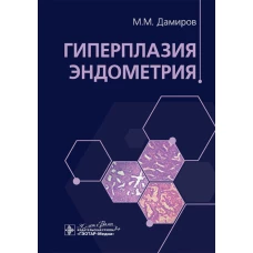 Гиперплазия эндометрия. Дамиров М.М.