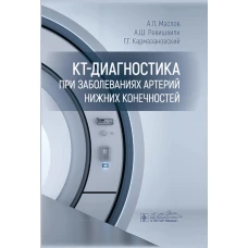 КТ-диагностика при заболеваниях артерий нижних конечностей